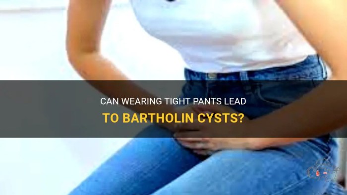 Can i swim with a bartholin cyst