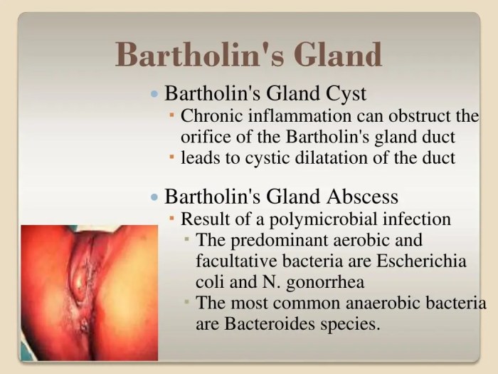 Can i swim with a bartholin cyst