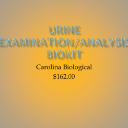 Hydrometer gravity label mark scale using urine solved boundaries upper lower normal range chegg urinalysis carolina answers examination transcribed problem