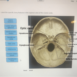 Skull lateral human brain case anatomy bones parts major figure