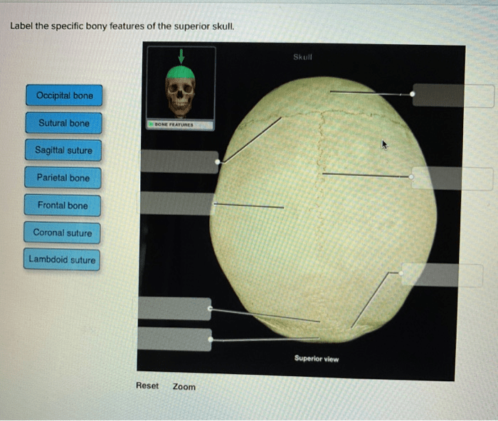 Label the specific bony features of the superior skull.